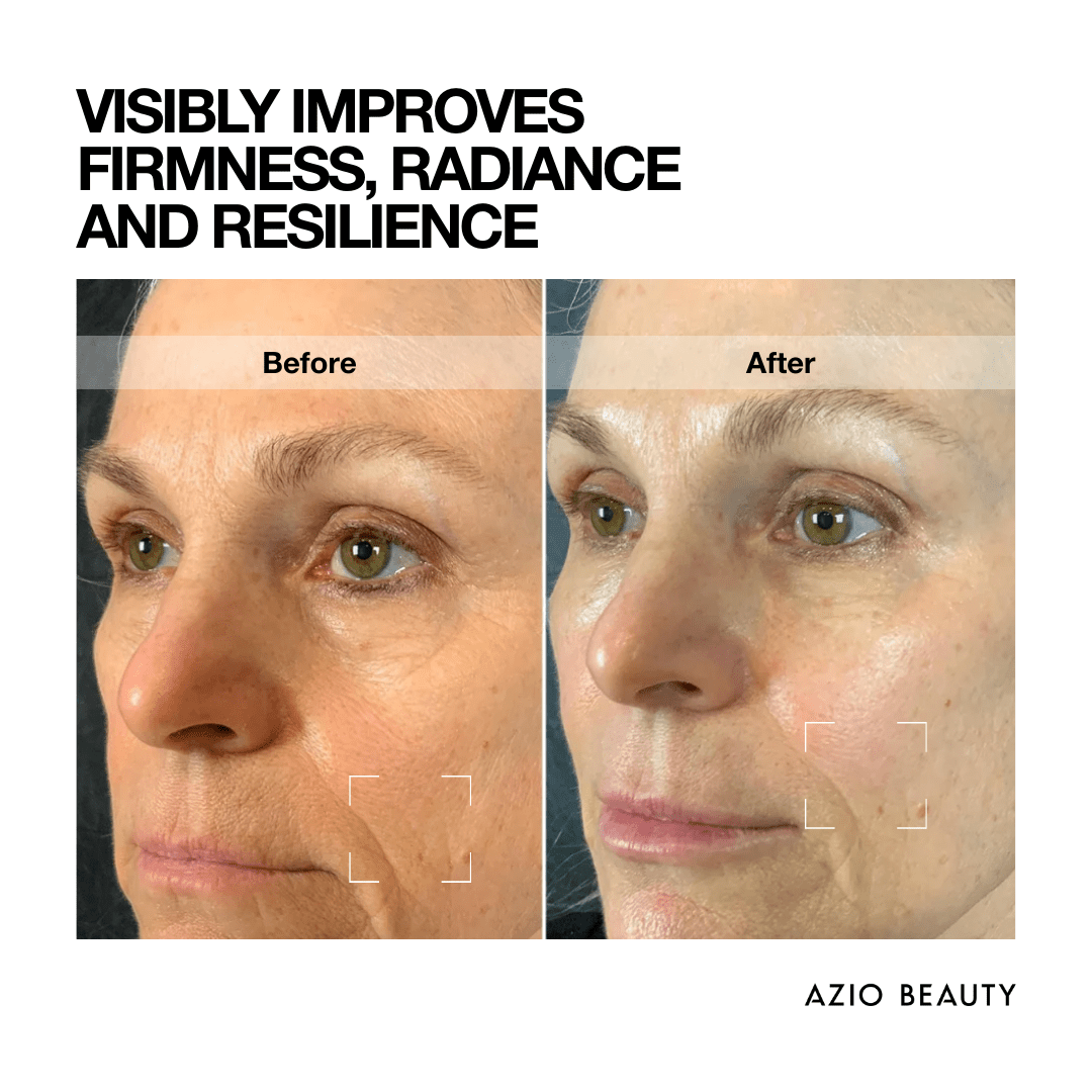 Intense Lifting DAY CREAM - Azio Beauty